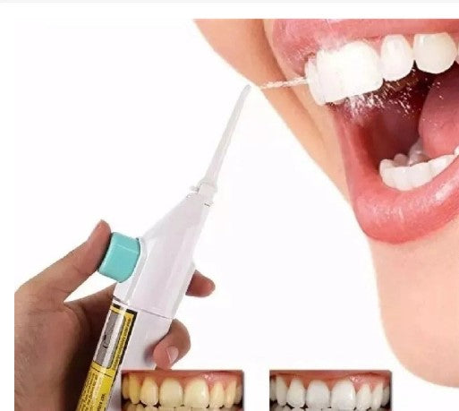 Jato De Agua Limpeza Oral Dental Irrigador Bucal -  (D25-JATODENTAL)